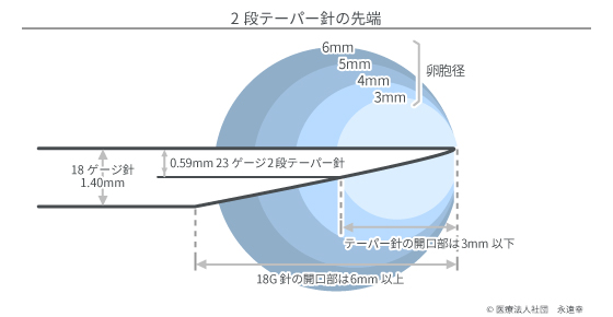 ２段テーパー針の先端