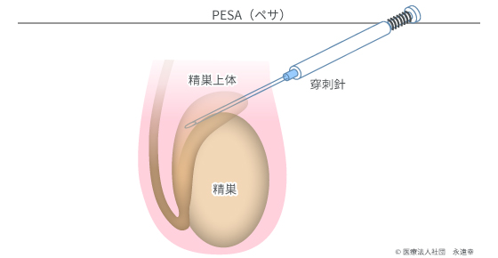 PESA（ペサ）