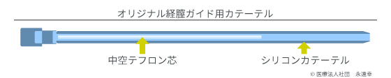 オリジナル経膣ガイド用カテーテル