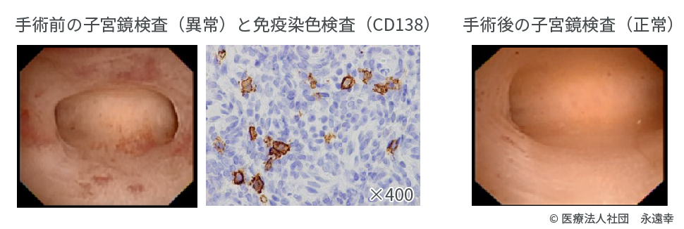 コラム Natural Art Clinic 日本橋 不妊治療 体外受精 男性不妊 東京都中央区